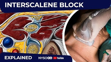 US-Guided Interscalene Brachial Plexus Block - Regional anesthesia Crash course with Dr. Hadzic