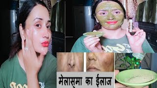 काली जिद्दी झाइयों दाग धब्बों को जड़ से खत्म करे - Remove Pigmentation Fast and Permanent||