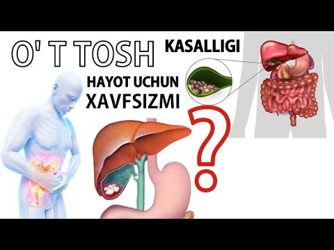 Video: Florit Toshi: Kelib Chiqishi, Tarqalishi Va Xususiyatlari