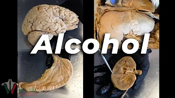 ¿Qué le hace el alcohol a tu aspecto?
