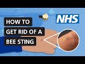 How To Get Rid Of A Bee Sting NHS 