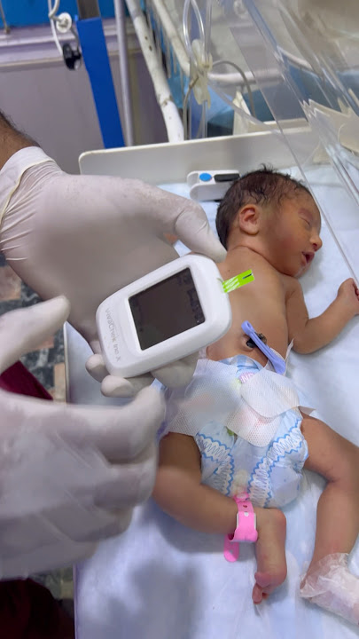 Checking Sugar Level of a Cute NICU Baby | NICU Baby Care