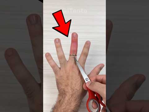 چطوری انگشتری که گیر کرده توی دستمون رو در بیاریم