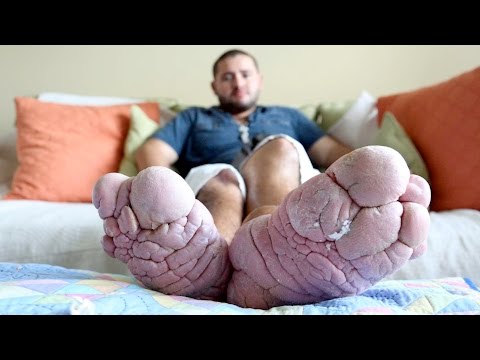 New Tlc Show Highlights People With Major Foot Problems Wild 94 9 Crystal Rosas