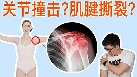 99%的人美丽芭蕾都练错了，一个技巧教你安全练好天鹅臂【叔贵】 - 天天要闻
