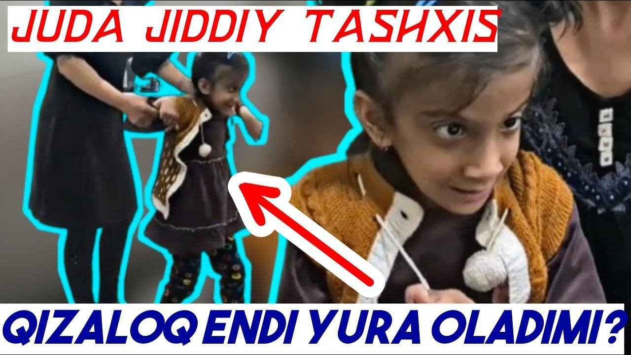 СМОЖЕТ ЛИ ХОДИТЬ РЕБЁНОК С ДИАГНОЗОМ СИНДРОМ ДЕНДИ-УОКЕРА, ГИДРОЦЕФАЛИЯ, ГИПОПЛАЗИЯ МОЗОЛИСТОГО ТЕЛА