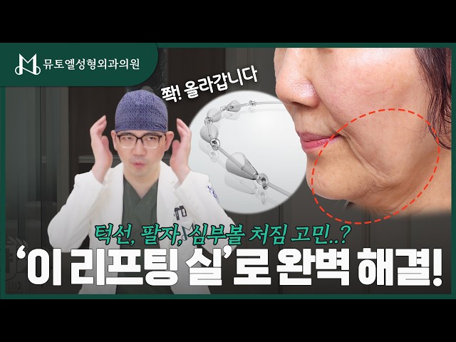 턱선, 팔자주름 고민되세요? 이 '실'로 완벽 해결!🔥#뮤토엘 #성형외과 #최준호 #최유섭피부과 #리프팅 #리프팅추천 #리프팅시술 #리프팅효과 #실루엣소프트 #실리프팅 #후기