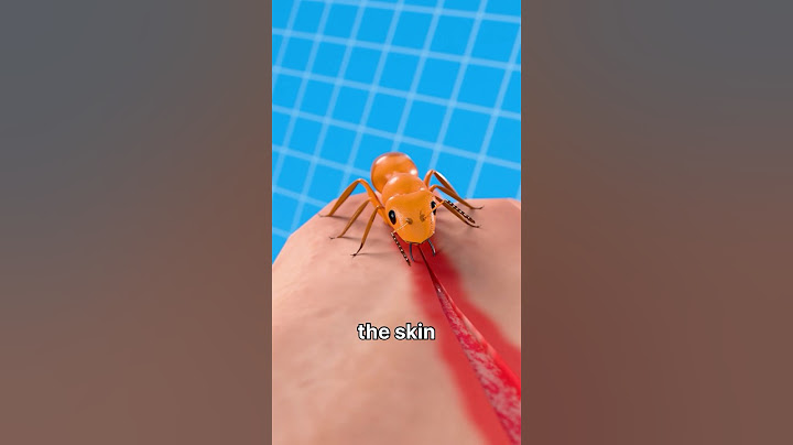 Using Ants to Heal Wound😮