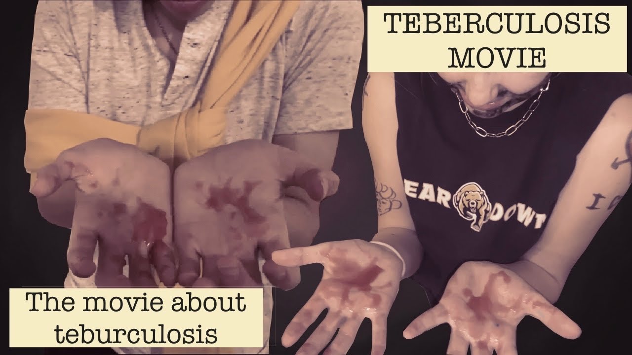 TUBERCULOSIS MOVIE (2021) YouTube