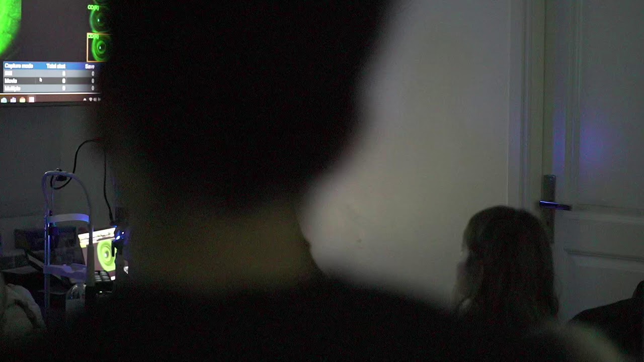 PauneLens™ 3R : Révolution en orthokératologie