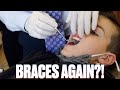 GETTING BRACES AGAIN?! GETTING BRACES FOR THE SECOND TIME