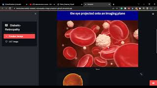 Deployment of Machine learning project using Streamlit News