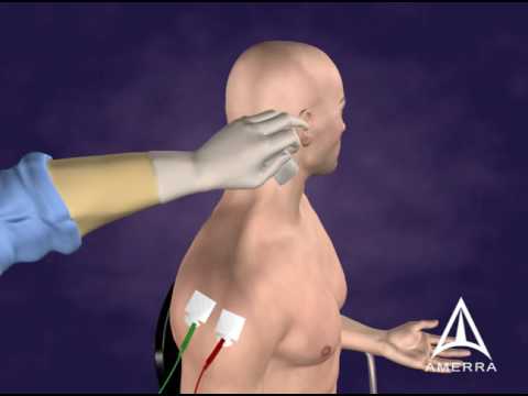 Botulinum Toxin B Injection Technique - 3D Medical Animation