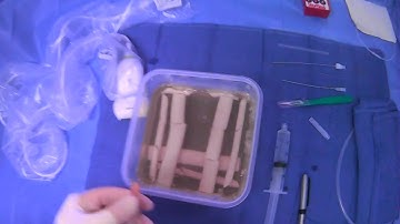 Preparing The Skin Prior To Internal Jugular Vein Puncture: Mark, Lidocaine Wheal And Dermatotomy