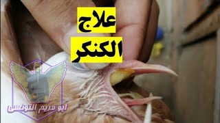 علاج مرض الكنكر عند الحمام بأسهل طرق العلاج