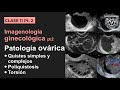 11.2 - Imagenología de los ovarios: Quistes simples y complejos, poliquistosis y torsión
