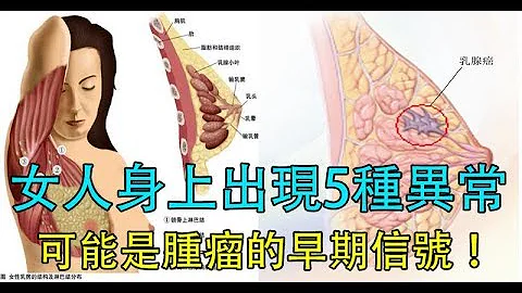 注意！女人身上出現5種異常，可能是「腫瘤」的早期信號！一定要小心，不然容易「癌變」！ - 天天要聞
