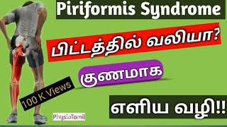 Piriformis Syndrome in Tamil|Piriformis Pain Relief Exercises|பிட்டத்தில் உள்ள வலிபோக எளிய வழி