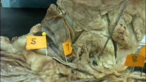 WLU Cat Dissection (Organs, Part 4)