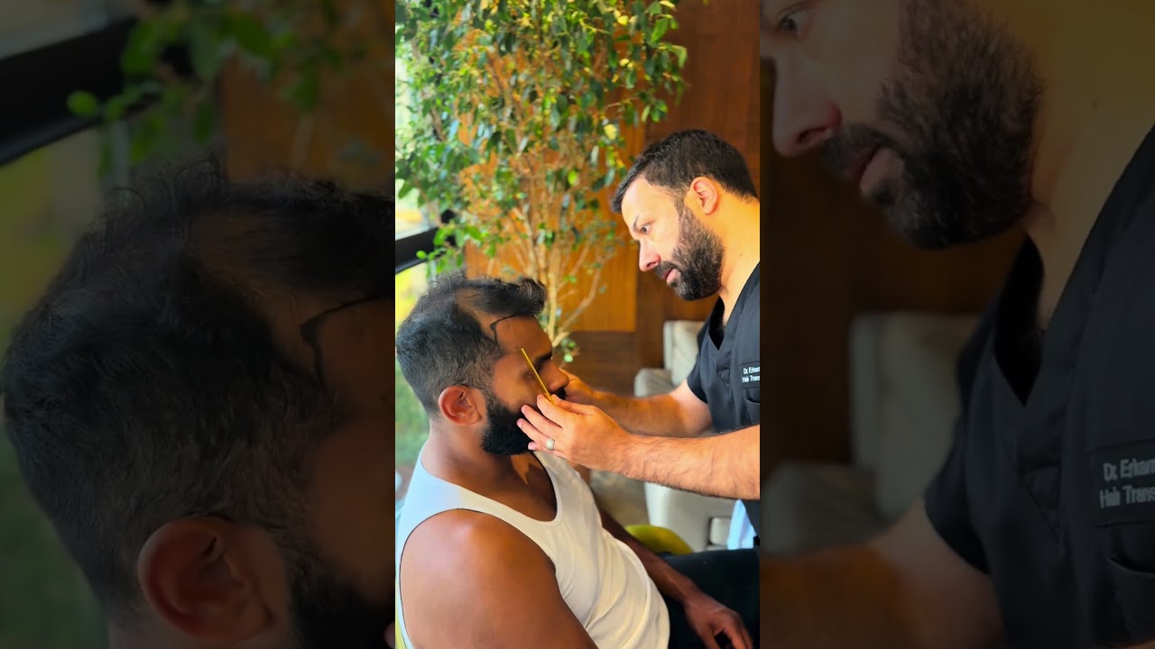 Hair Transplant Istanbul