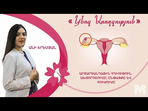 Արտարգանդային հղիութուն   Ախտորոշումը, ընթացքը և բուժումը․ «Կնոջ Առողջություն»