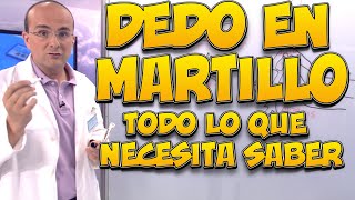 DEDO EN MARTILLO - Todo lo que necesita saber