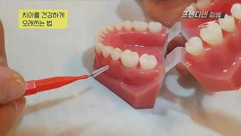 치간칫솔 치실 사용법 : 임플란트 하신 분들 꼭 알고계세요. (근데..잘못 사용하면 더 안좋아질수도..)