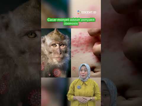 Video: Bolehkah cacar lembu menjangkiti manusia?