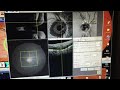 Eye Tissue Segmentation technology  :Best Eye hospital