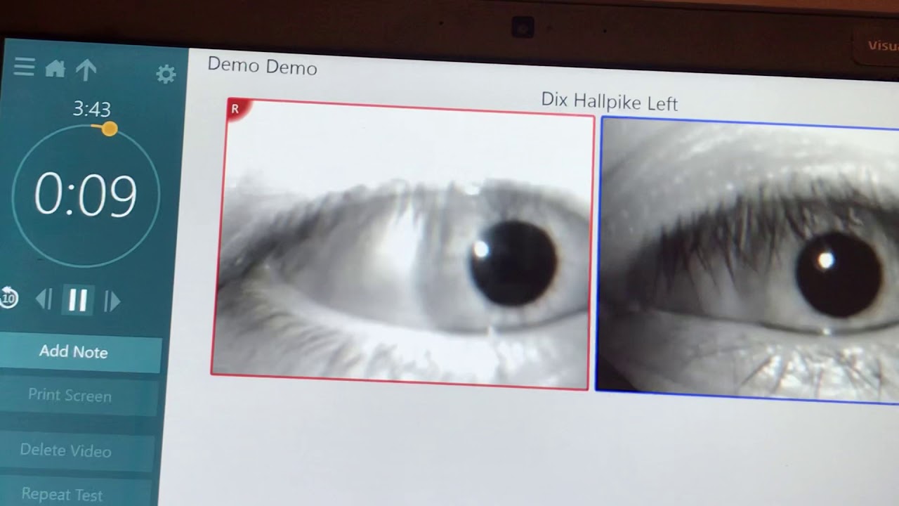 What vertigo looks like in your eyes YouTube
