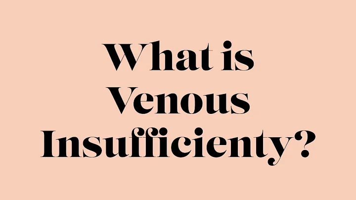 Venous Insufficiency | TheWalkingCompany | Keep On Walking