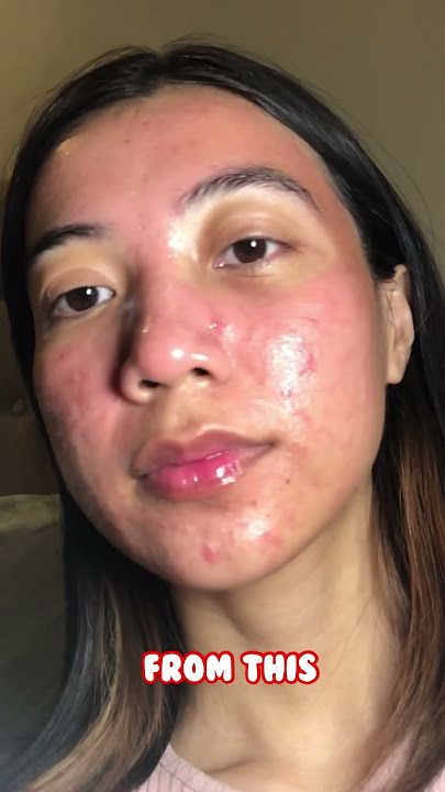 Moisturizer 40 Ribu bisa meredakan kemerahan? | The originote moisturizer Review