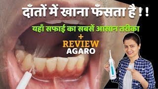 दाँतों में खाना फँसता है | यहाँ सफाई का सबसें आसान तरीका | agaro water flosser