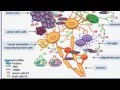 Advancing the Treatment of Malignant Gliomas (Glioblastoma) Video – Brigham and Women’s Hospital