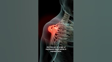 Have You Tried Dry Needling The Supraspinatus To Help Relieve Shoulder Pain?