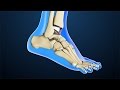 Total Ankle Replacement Surgery | Nucleus Health
