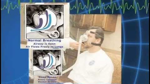 Video Tour of a Sleep Study