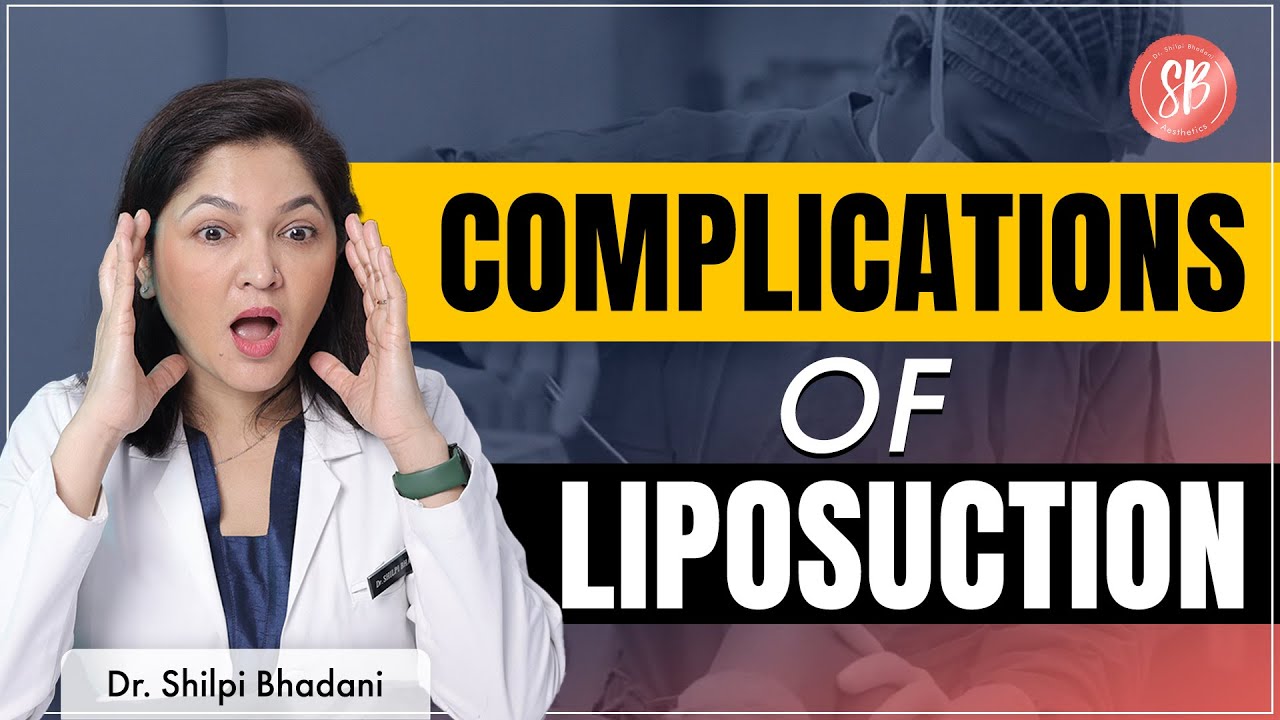 Liposuction side effects Liposuction Surgery in Gurgaon SB