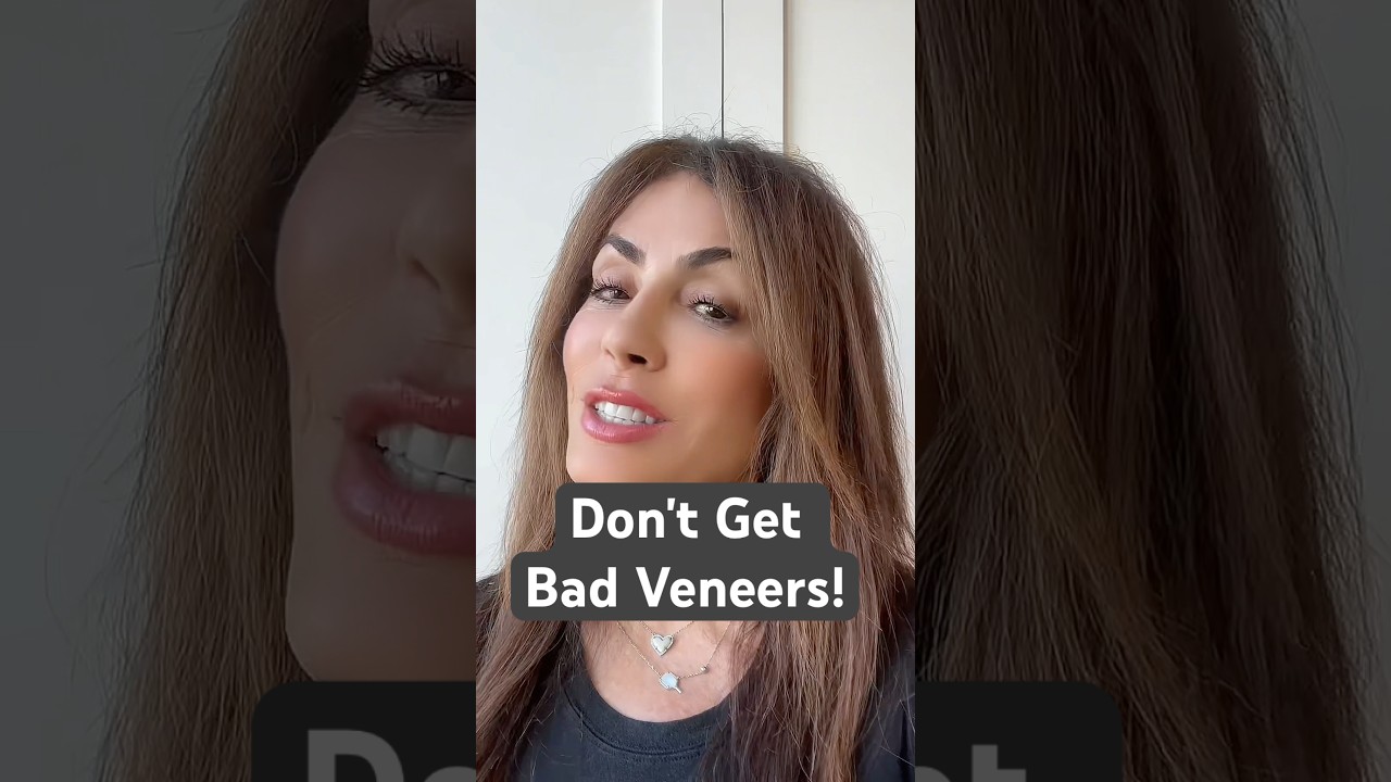 Don't Get Bad Veneers! Before you get veneers, ask THIS.