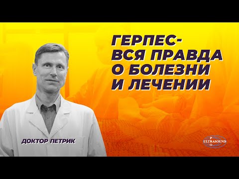 Герпес - вся правда о болезни и лечении.