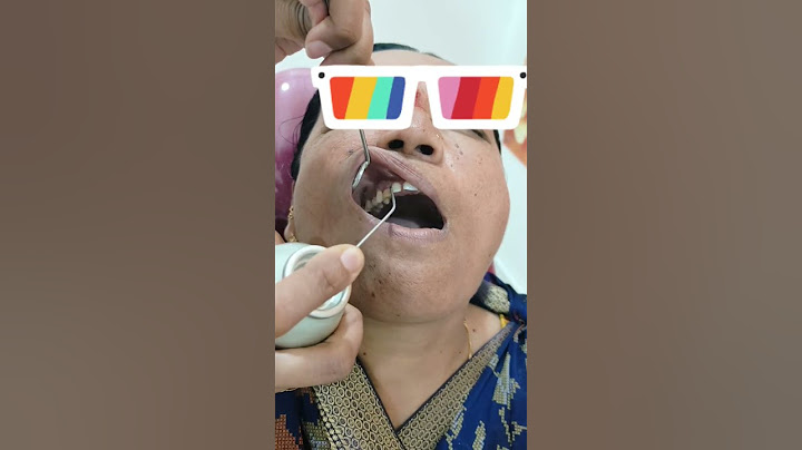 दूध का दांत👶 #trending #shorts #youtubeshorts #ytshorts #dant #teeth #dr #viral