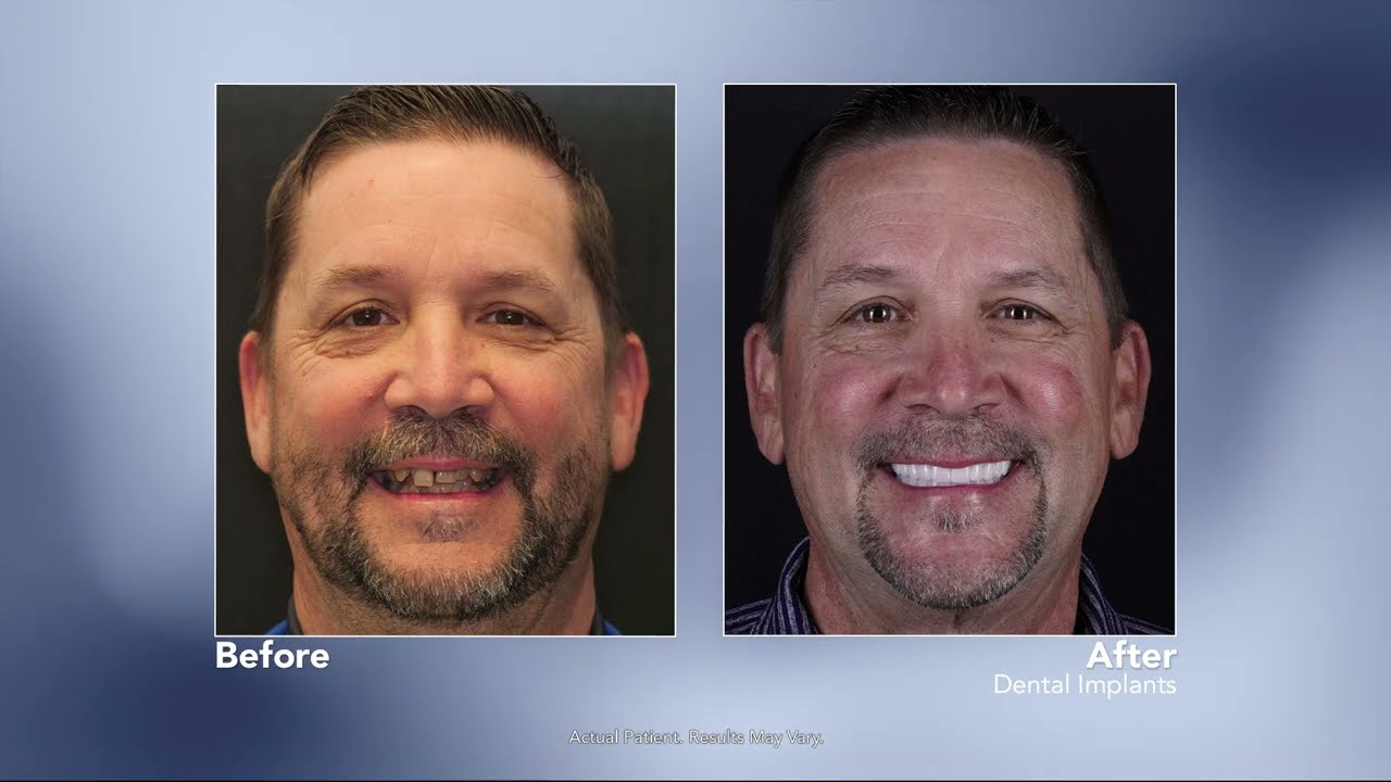 FLOSS Dental's Dr. Mike Tran on The Wellness Hour with Randy Alvarez