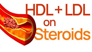 Cholesterol on testosterone: HDL and LDL Lipids