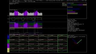 MGM GRT screenshot 5