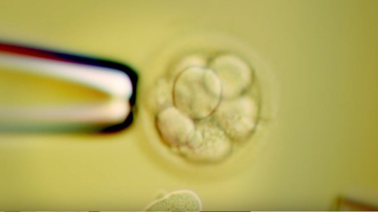 Are Cosmetically Engineered Babies Changing The Course Of Evolution? | Earth Lab