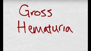 Gross Hematuria: Just a Bit of Kool-Aid