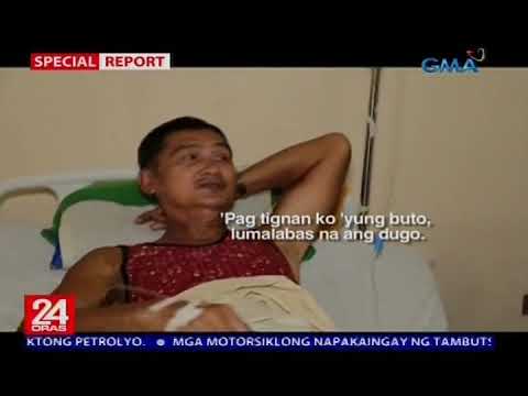 Pasyentiis: Labuan Public Hospital, may pinakamababang budget sa mahigit 60 DOH-funded hospitals