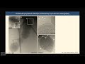 Obligate Symbionts and Other Intriguing Members of Human Microbiomes