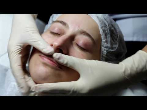 Diamond Microdermabrasion \u0026 Facial Massage ალმასის მიკროდერმაბრაზია და სახის მასაჟი