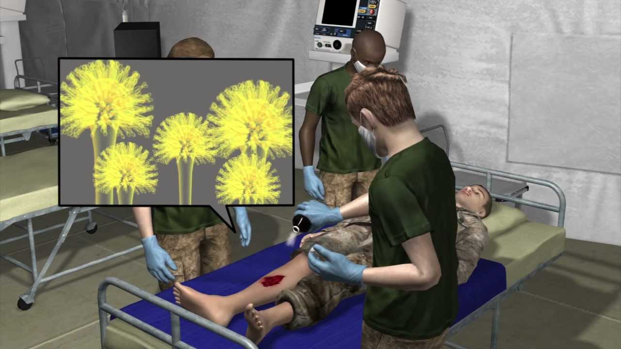 Military doctors fighting fungal infections in wounded Afghanbased US